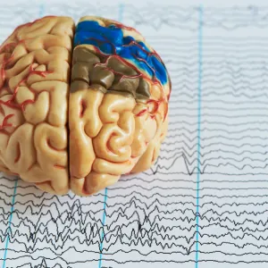 A brain sitting on top of a patient's brainwave activity during neurofeedback training.